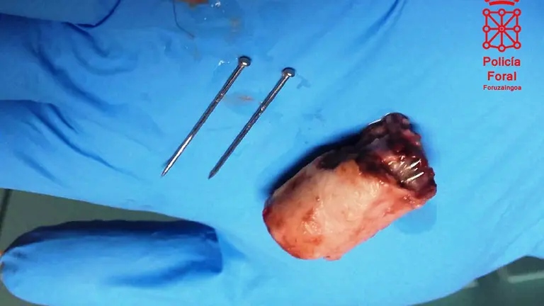 Salchica con clavos encontrada. POLICÍA FORAL