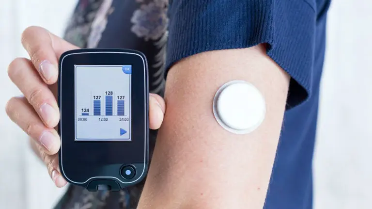 Monitorización flash del nivel de glucosa. ARCHIVO