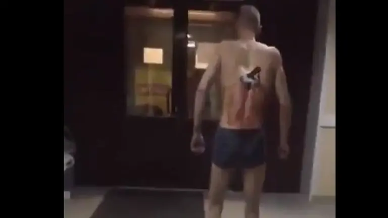 Un hombre sali&oacute; de un hospital  con un cuchillo en la espalda para fumar. TWITTER