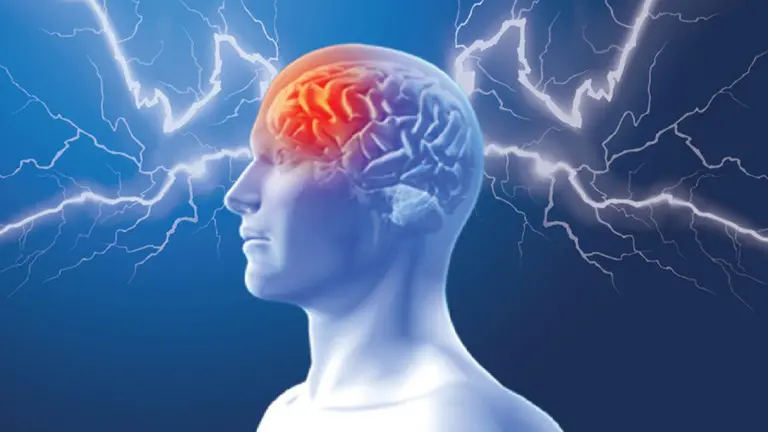 Imagen del cerebro de una persona con síndrome de Dravet. ARCHIVO