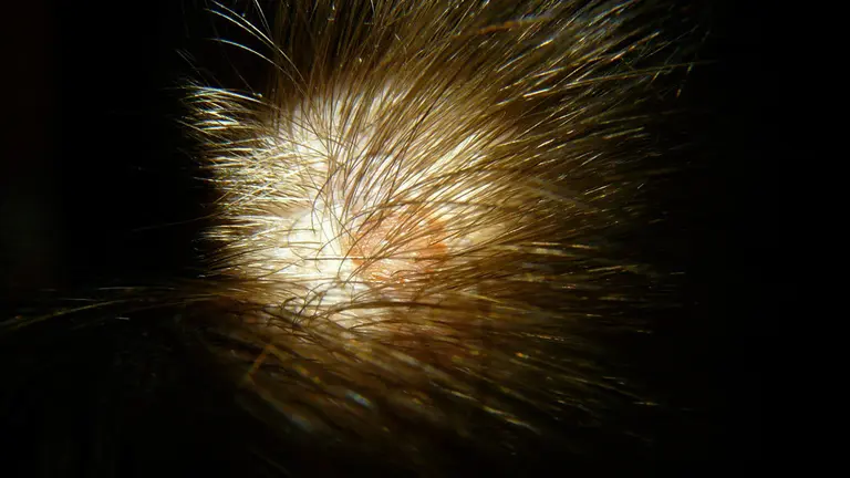 La cabeza de un hombre. ARCHIVO