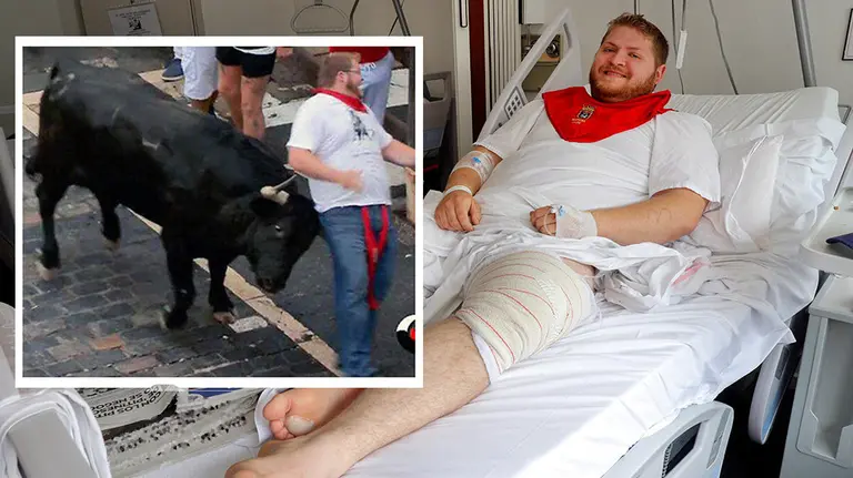GRAFCAV6147. PAMPLONA (NAVARRA), 08/07/2019.- El estadounidense Aaron Froelicher, herido por asta de toro en el muslo izquierdo en el tramo de Telefónica en el primer encierro de los Sanfermines de este año, durante la entrevista concedida a Efe este lunes en el Complejo Hospitalario de Navarra, donde permanece ingresado, y en la que ha afirmado que el próximo año volverá a correr porque quiere intentarlo de nuevo. EFE/Villar López