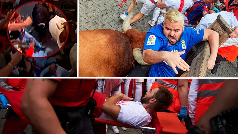Imágenes del corredor de Cascante corneado en Santo Domingo en el encierro del día 12 y de dos de los corneados en el último encierro en la zona del Callejón de la Plaza de Toros NAVARRACOM