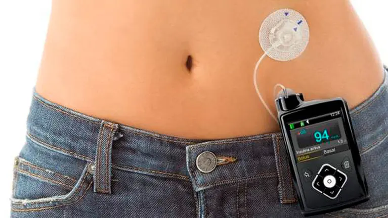 Una bomba de insulina. MEDTRONIC