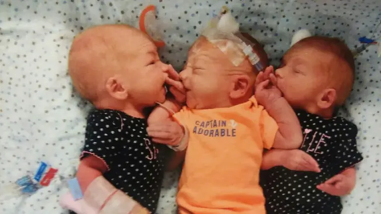 trillizos nacidos tras un dolor por piedras en el ri&ntilde;on de una mujer norteamericana