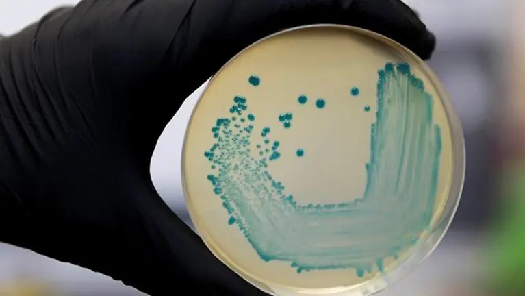 Un científico comprueba una muestra de laboratorio EUROPA PRESS