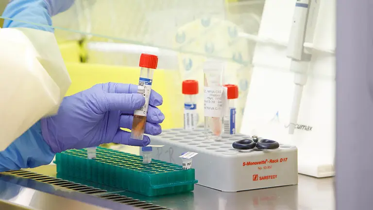 Tubo de muestra de coronavirus para PCR - coronavirus