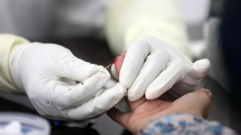 Una persona extrae sangre para poder efectuar un test inmunológico de coronavirus. EFE/EPA/HOTLI SIMANJUNTAK/EPA-EFE