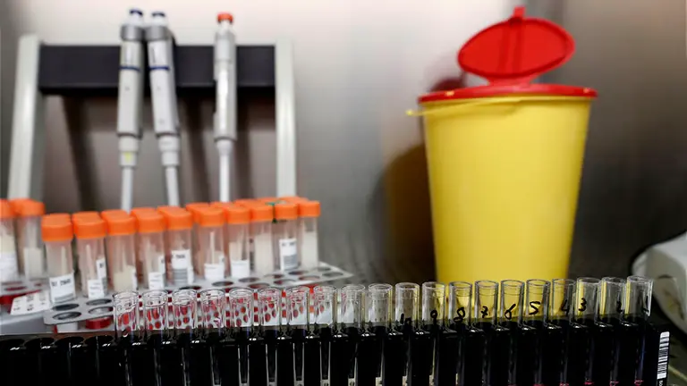 Varias muestras de PCR después someterlas a su preparación (pool) para su posterior análisis en el Servicio de Microbiología Clínica del Complejo Hospitalario de Navarra que trabaja a destajo desde el inicio de la pandemia, con picos de casi 5.000 PCR analizadas en un solo día, sus responsables piden a la población que actúe &#34;como si todos estuviéramos contagiados&#34;. Las PCR habituales tardan cinco horas en dar resultados, a lo que hay que sumar un proceso previo “de muestras a registrar, comprobar que los datos están bien...”. Es una técnica que “tarda cinco horas en hacerse y que no se puede bajar de ese tiempo”, resaltan. EFE/ Jesús Diges