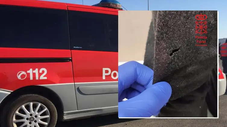 detalle de la cuchillada de la mujer que ha sido detenida en Bara&ntilde;&aacute;in por acuchillar a su pareja en un hombro. POLIC&Iacute;A FORAL