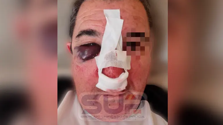 Agresión a un Policía Nacional de Tudela en Zaragoza. SUP