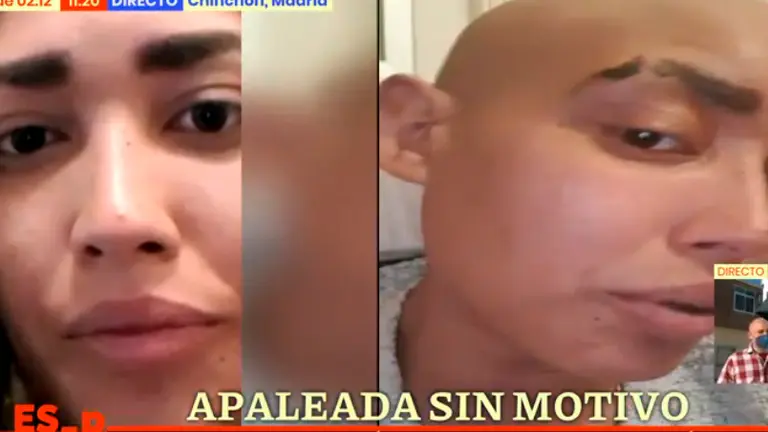 Una joven con c&aacute;ncer denuncia haber sido agredida y apaleada en la puerta de una discoteca de Pamplona.