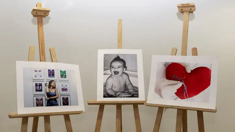 Cuadros que reflejan las cardiopatías. PEQUEÑA GUERRERA