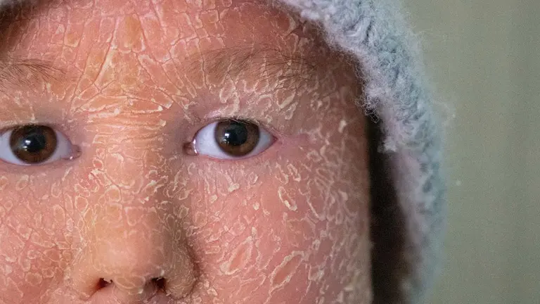 Ariadna, The fish skin