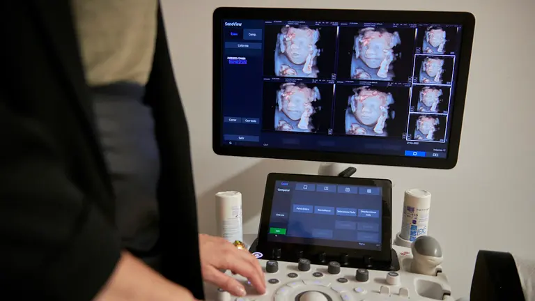 Ecoilusión es un centro de ecografías donde puedes conocer a tu bebé antes de que nazca. IRANZU LARRASOAÑA