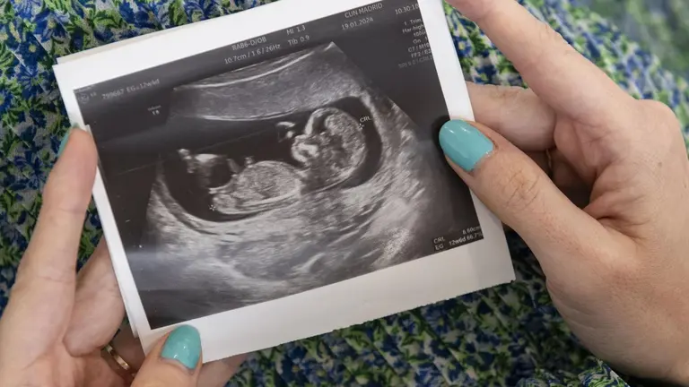 Una madre sostiene la imagen de una ecografía realizada en la Clínica Universidad de Navarra. CEDIDA