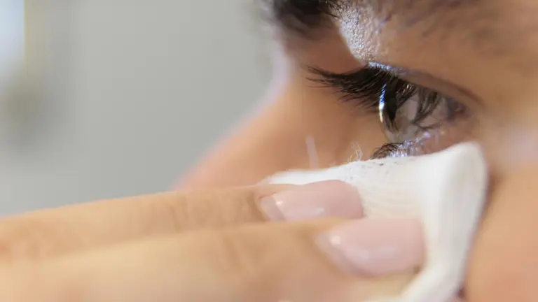 El lavado con agua tibia o el uso de toallitas específicas para el párpado son la mejor forma de reducir el riesgo de orzuelos y de evitar su recurrencia. CLÍNICA UNIVERSIDAD DE NAVARRA