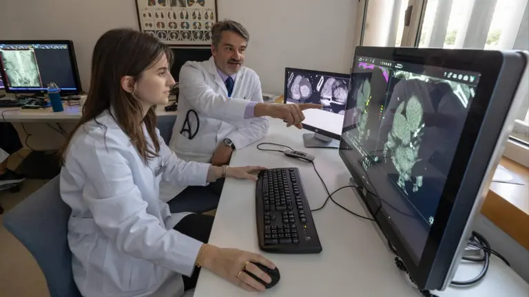 El Dr. Juan Pablo de Torres, codirector del Departamento de Neumología, con la Dra. Ana Ezponda, especialista en radiodiagnóstico de la Clínica Universidad de Navarra. CEDIDA
