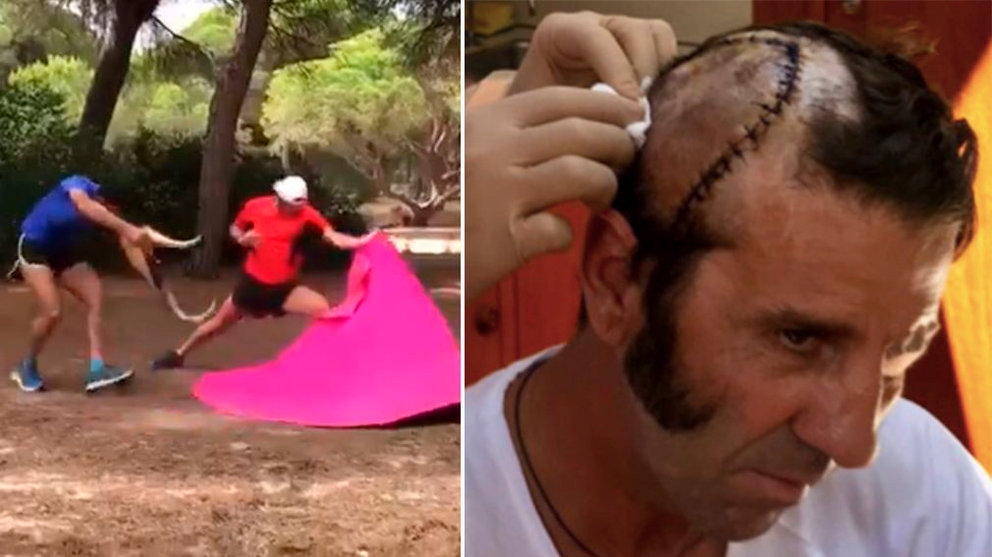 Juan José Padilla vuelve a entrenar con el capote tras sufrir una cornada en el cuero cabelludo de la que se recupera para torear en San Fermín este viernes 13 de julio Foto TWITTER MANOLO MOLÉS 1