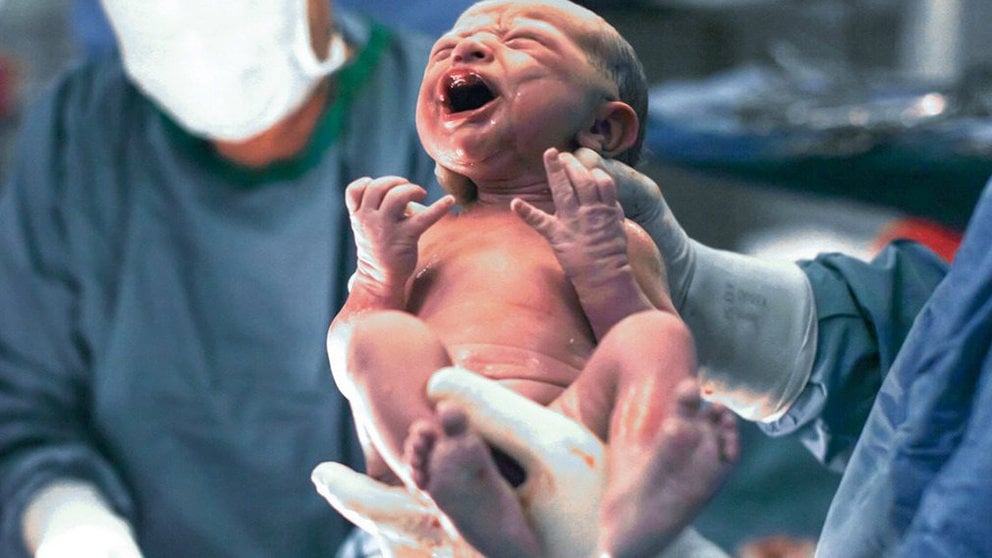 Imagen de un médico sosteniendo a un bebé recién nacido después de un parto en el quirófano de un hospital. ARCHIVO