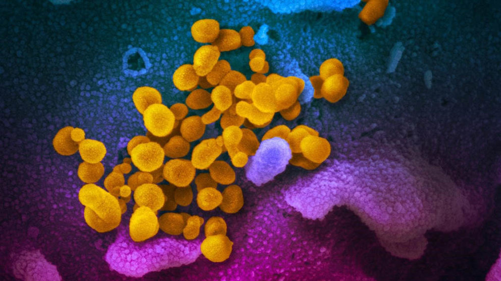 Imagen de microscopio electrónico de barrido muestra SARS-CoV-2 (amarillo), también conocido como 2019-nCoV, el virus que causa COVID-19, aislado de un paciente en los EE. UU. ) cultivados en el laboratorio.