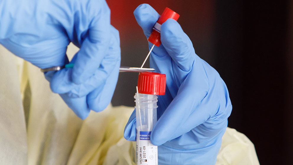 Test de coronavirus en Refena a personal con sintomatología de profesiones esenciales. GOBIERNO DE NAVARRA (37)