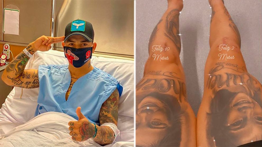 Montaje con imágenes del Chimy Ávila, en la izquierda tras su segunda operación y en la derecha 'felicitando' su heridas INSTAGRAM CHIMY_AVILA