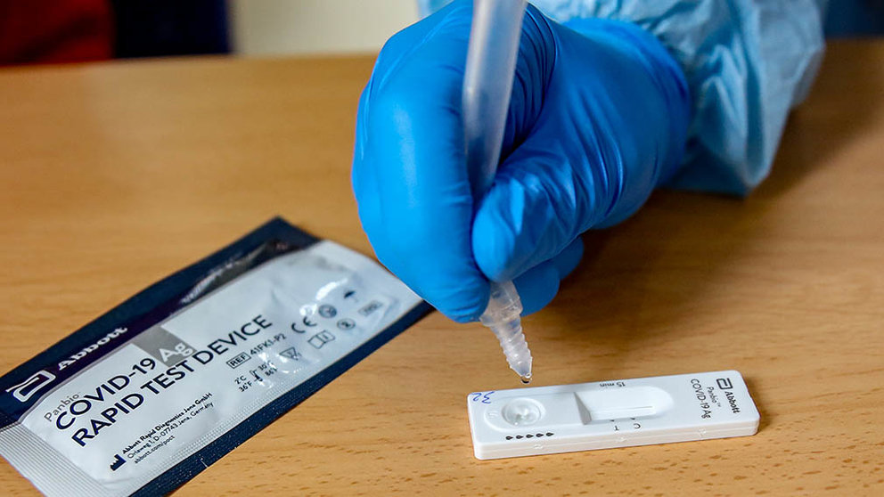 Material necesario para la realización de test de antígenos en un dispositivo. EUROPA PRESS