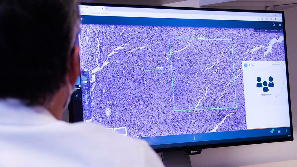 Los hospitales navarros digitalizan sus servicios de Anatomía Patológica para agilizar tiempos y mejorar la calidad en el diagnóstico de enfermedades como el cáncer. GOBIERNO DE NAVARRA