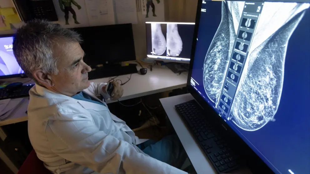 El Dr. Luis Pina, especialista del Área de Cáncer de Mama del CCUN. CLÍNICA UNIVERSIDAD DE NAVARRA