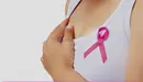 Cáncer de Mama. ARCHIVO