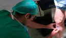 Un paciente se somete al nuevo método para tratar las varices de forma ambulatoria.