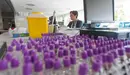 Imagen del Laboratorio de Bioquímica Clínica de la Clínica Universidad de Navarra.