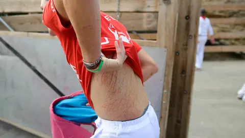 Imanol Henares, jefe de lidia en Falces, el día después de su caída durante el encierro del Pilón PABLO LASAOSA 2