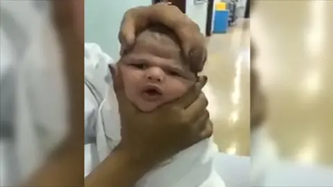 Fotograma del vídeo en el que unas enfermeras deforman la cara a un bebé