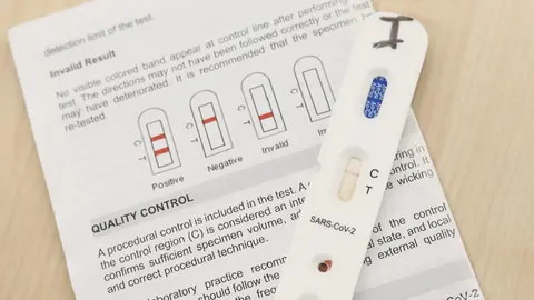 Kit utilizado para la realización de los test rápidos. GOBIERNO DE NAVARRA