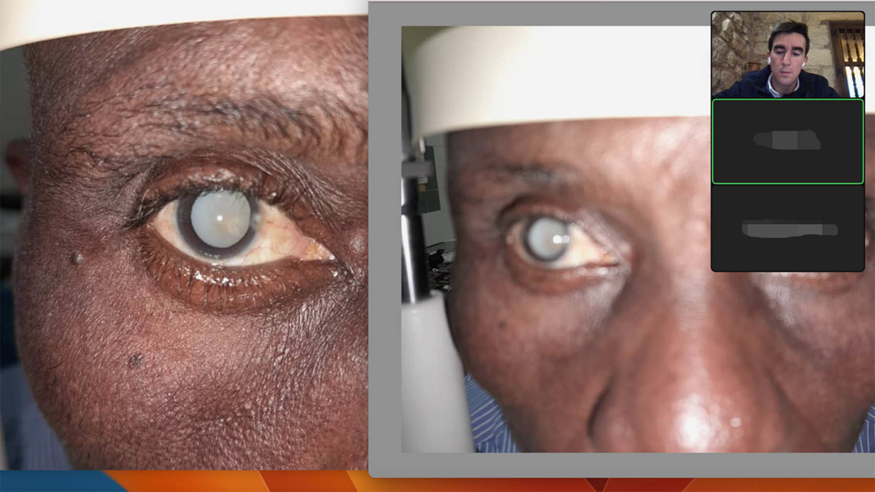 Los profesionales voluntarios de la fundación NAMA de Navarra detectan patologías oculares en el Congo de forma telemática. CEDIDA