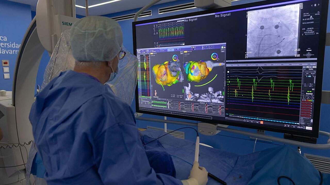 La Clínica Universidad de Navarra lidera un avance que puede cambiar el tratamiento de una arritmia muy común