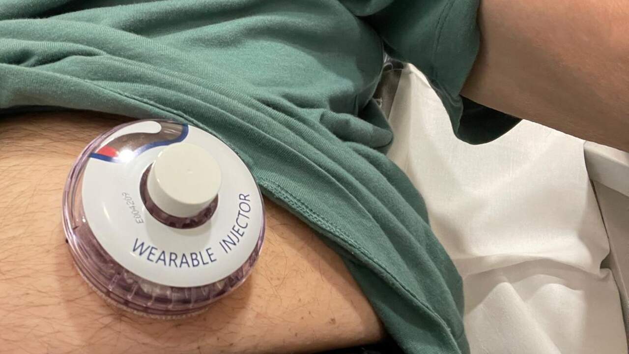 Manuel, un navarro que convive con un cáncer sin cura: 